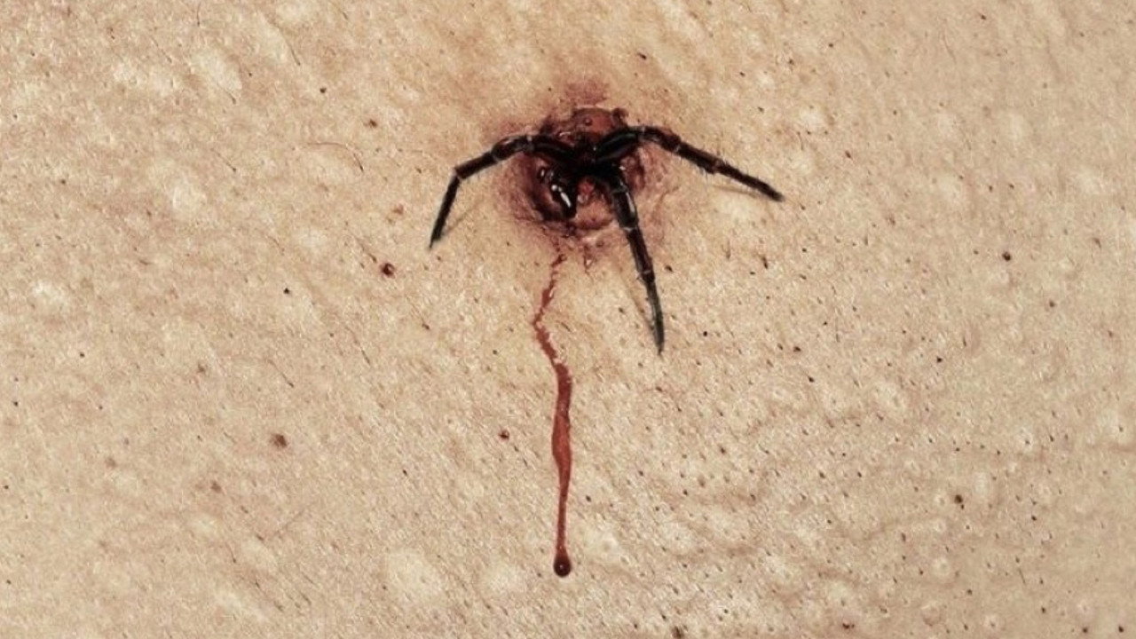 The Plague
