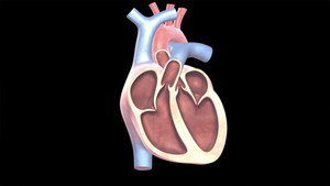 Heart Disease: #3 Dangerous Atrial Fibrillation
